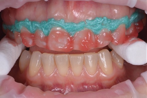 خدمات دندانپزشکی زیبایی و ترمیمی