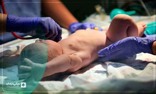 بهترین دکتر ختنه نوزاد در تهران